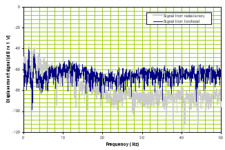 BAM TBI frequency domain waveform